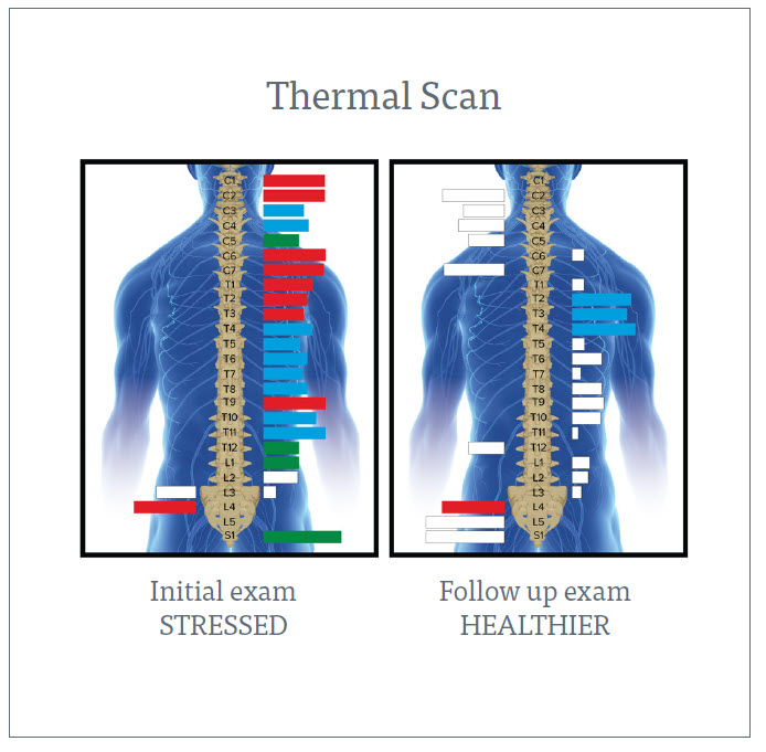 emg scan initial-followup INSiGHT Scannig Technology