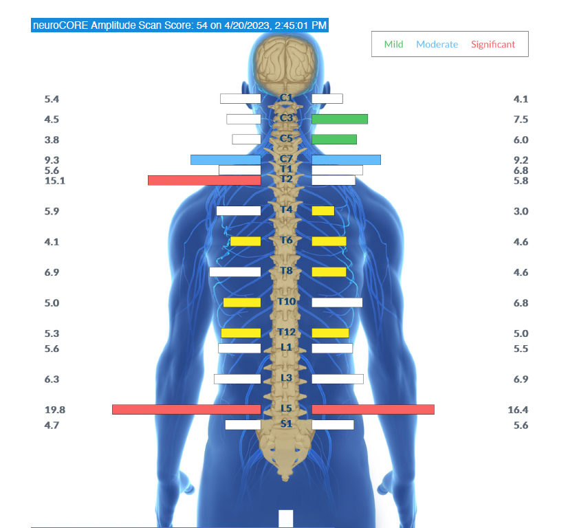 stressed out INSiGHT scan